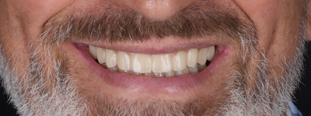 Sorriso depois do tratamento